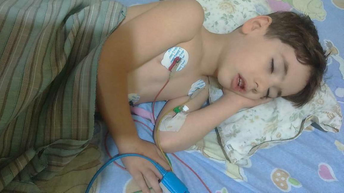 وفاة الطفل أسامة الطوخي في الغوطة الشرقية المحاصرة (فيسبوك)
