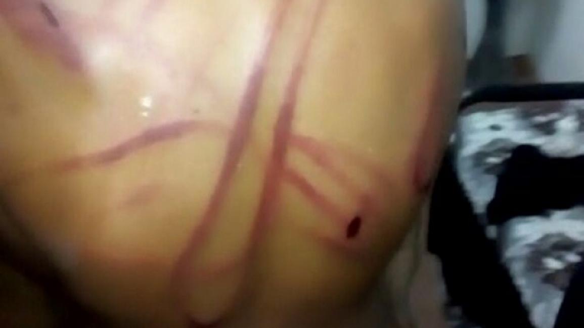 السعودية-مجتمع-طفل اعتداء على طفل من تبوك (فيسبوك)
