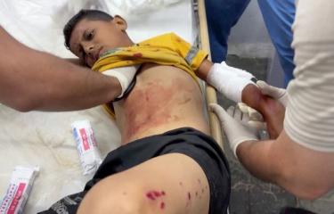 طفل مصاب جراء غارة إسرائيلية على خيام النازحين في رفح 26 مايو رويترز