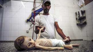 قضى الرضيع فايز أبو عطايا بسبب سوء التغذية (أشرف أبو عمرة/الأناضول)