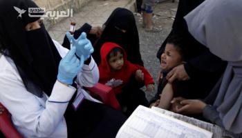 الحصبة تفتك بأطفال اليمن وسط تدهور صحي