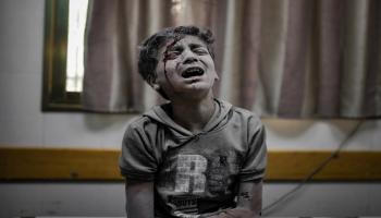 طفل فلسطيني مصاب جرّاء القصف الإسرائيلي يبكي في مشفي في دير البلح وسط قطاع غزّة 7/ 11/ 2023 (الأناضول)