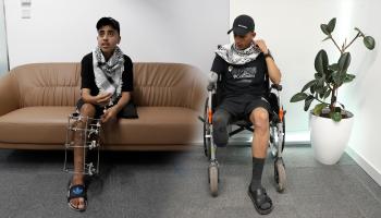أصيب حسن وأحمد في قطاع غزة (حسين بيضون)