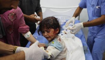 تعرض آلاف من أطفال غزة لإصابات خلال العدوان (إياد البابا/فرانس برس)